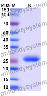 Recombinant Human SLC12A2 Protein, N-His