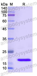 Recombinant Human SLC12A3 Protein, N-His