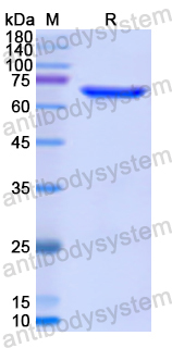 Recombinant Human PSMD4 Protein, N-GST