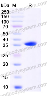 Recombinant Human VCP Protein, N-His