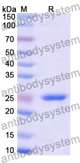 Recombinant Human AQP4/Aquaporin-4 Protein, N-His-KSI