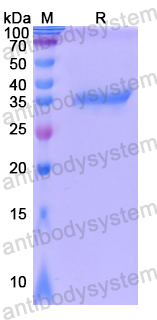 Recombinant Human NAP1L1 Protein, N-His