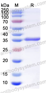 Recombinant Human ADK Protein, N-His