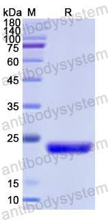 Recombinant Human CDH15 Protein, N-His