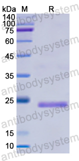 Recombinant Human FOXA1 Protein, N-His