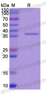 Recombinant Human SEC13 Protein, N-His