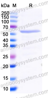 Recombinant Human OXCT1 Protein, N-His