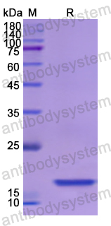 Recombinant Human UCP2 Protein, N-His