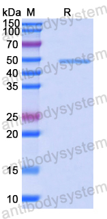 Recombinant Human EIF3B Protein, N-His