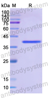 Recombinant Human FCGRT Protein, N-His