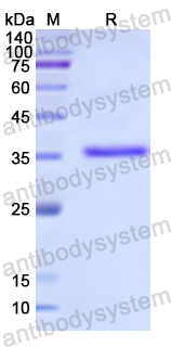 Recombinant Human UCP3 Protein, N-His