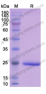 Recombinant Human BID Protein, N-His