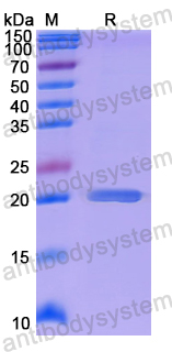Recombinant Human DLX5 Protein, N-His-SUMO & C-Strep