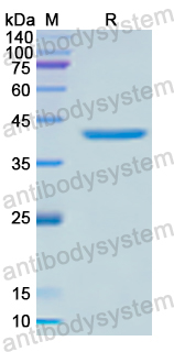 Recombinant Human CTSW Protein, N-His