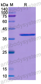 Recombinant Human LGALS4 Protein, N-His