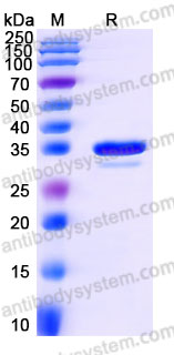Recombinant Human LGALS4 Protein, C-His