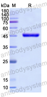 Recombinant Human HDAC4 Protein, N-His