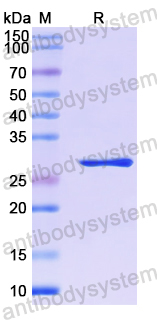 Recombinant Human EIF6 Protein, N-His