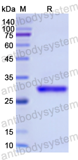 Recombinant Human CTBP2 Protein, N-His