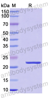 Recombinant Human ARL4C Protein, N-His