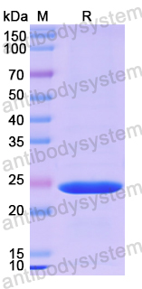 Recombinant Human SOX10 Protein, N-His-SUMO