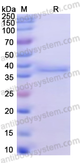 Recombinant Human WNT3A Protein, N-His