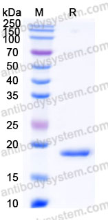 Recombinant Human CLDN18/Claudin-18 Protein, N-8*His