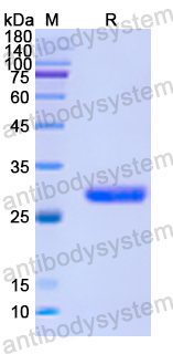 Recombinant Human BCAR1 Protein, N-His