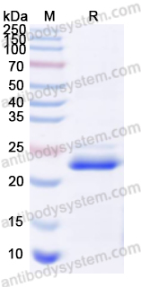 Recombinant Human MAP3K7CL Protein, N-His