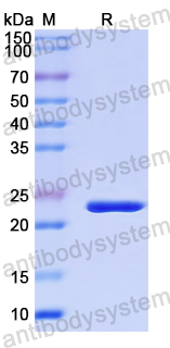 Recombinant Human FOXL2 Protein, N-His-SUMO & C-Strep
