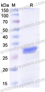 Recombinant Human LOXL3 Protein, N-His