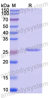 Recombinant Human ADAMTS12 Protein, N-His