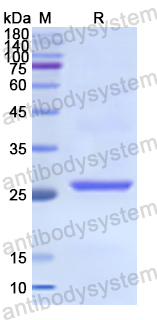 Recombinant Human TIRAP Protein, N-His