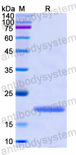 Recombinant Human ARPC4 Protein, N-His