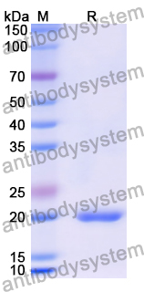 Recombinant Human DEFB1 Protein, N-His-KSI