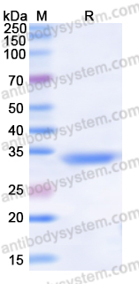 Recombinant Human TPI1 Protein, N-His