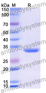 Recombinant Human PLP1 Protein, N-GST & C-His