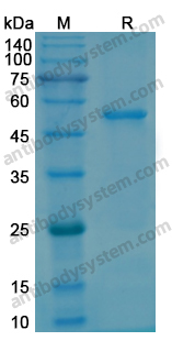 Recombinant Human PTEN Protein, N-His