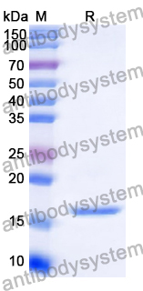 Recombinant Human IL2 Protein, C-His
