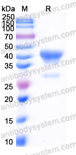 Recombinant Human ACTB/&beta;-actin/Beta Actin Protein, C-His