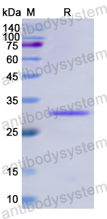 Recombinant Human EIF4A1 Protein, N-His