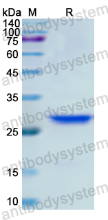 Recombinant Human ZP1 Protein, N-His