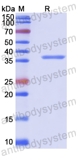 Recombinant Human PRPS1 Protein, N-His