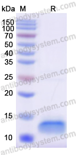 Recombinant Human S100A10 Protein, N-His