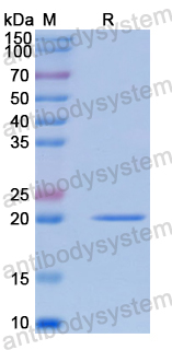 Recombinant Human RAB8A Protein, N-His