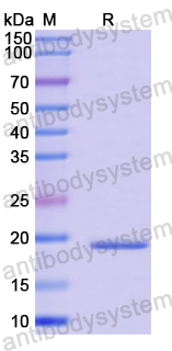 Recombinant Human UBE2D3 Protein, N-His
