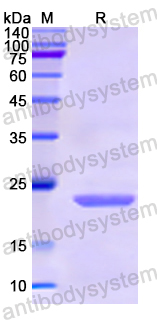 Recombinant Human UBE2M Protein, N-His