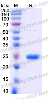 Recombinant Human UBE2M Protein, Tag free