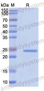 Recombinant Human UBE2K Protein, N-His
