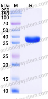 Recombinant Human UBE2K Protein, N-His-SUMO